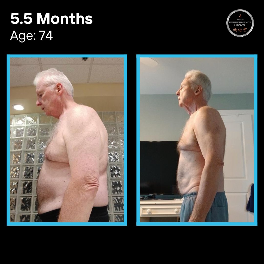 Michael — Attorney, 75 — 36 lbs lost in 5.5 months